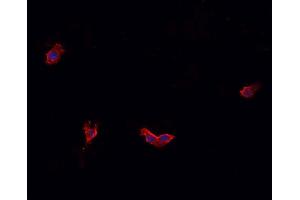 ABIN6269331 staining HeLa cells by IF/ICC. (Caldesmon antibody  (C-Term))