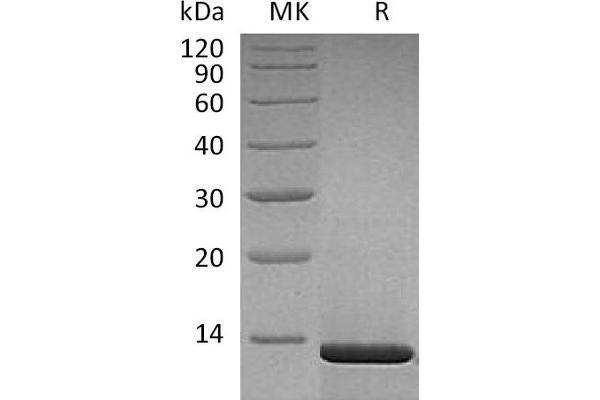 NGFB Protein