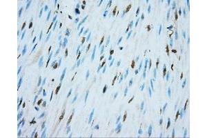 Immunohistochemical staining of paraffin-embedded colon tissue using anti-NIT2 mouse monoclonal antibody.