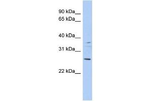 WB Suggested Anti-ASCL2 Antibody Titration:  0. (ASCL2 antibody  (Middle Region))