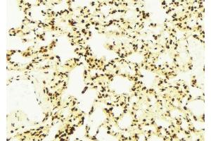 ABIN6278854 at 1/100 staining Mouse lung tissue by IHC-P. (DNAJA1 antibody  (C-Term))
