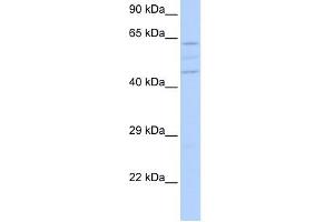 VPS37A antibody used at 1 ug/ml to detect target protein. (VPS37A antibody)