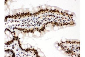 Immunohistochemistry (Paraffin-embedded Sections) (IHC (p)) image for anti-Retinoblastoma Binding Protein 4 (RBBP4) (AA 395-425), (C-Term) antibody (ABIN3043920) (Retinoblastoma Binding Protein 4 antibody  (C-Term))