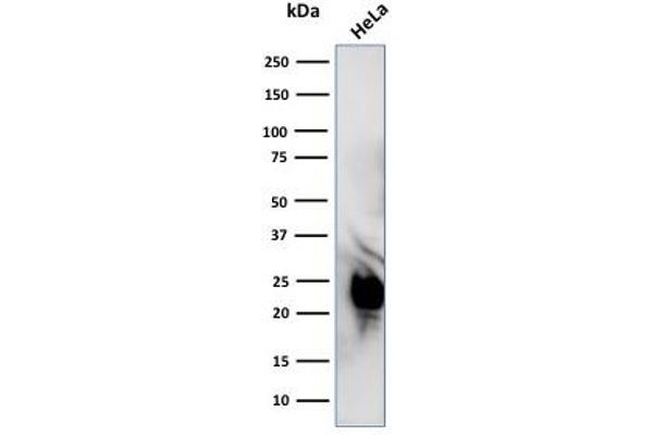 GLO1 antibody