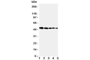 Western blot testing of Flotillin 1 antbody; Lane 1: rat lung;  2: (r) brain;  3: (r) ovary;  4: human SMMC-7721;  5: (h) MFC-7 cell lysate. (Flotillin 1 antibody  (Middle Region))