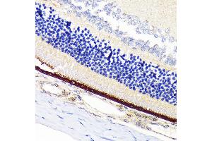 Immunohistochemistry of paraffin-embedded rat retina using RPE65 Rabbit mAb (ABIN7269933) at dilution of 1:100 (40x lens). (RPE65 antibody)
