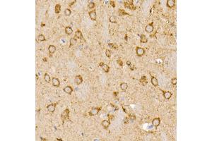 Immunohistochemistry of paraffin-embedded rat brain using Prohibitin Rabbit pAb (ABIN3020627, ABIN3020628, ABIN3020629 and ABIN6213601) at dilution of 1:25 (40x lens).