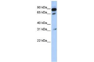 Western Blotting (WB) image for anti-ATP-Binding Cassette, Sub-Family D (Ald), Member 4 (ABCD4) antibody (ABIN2458768) (ABCD4 antibody)
