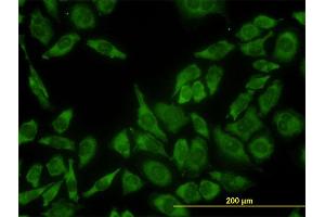 Immunofluorescence of monoclonal antibody to RPL13 on HeLa cell. (RPL13 antibody  (AA 112-211))