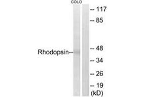 Western blot analysis of extracts from COLO cells, using Rhodopsin (Ab-334) Antibody. (Rhodopsin antibody  (AA 299-348))