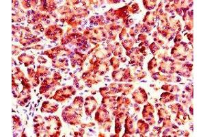 Immunohistochemistry of paraffin-embedded human pancreatic tissue using ABIN7161824 at dilution of 1:100 (NUP85 antibody  (AA 201-500))