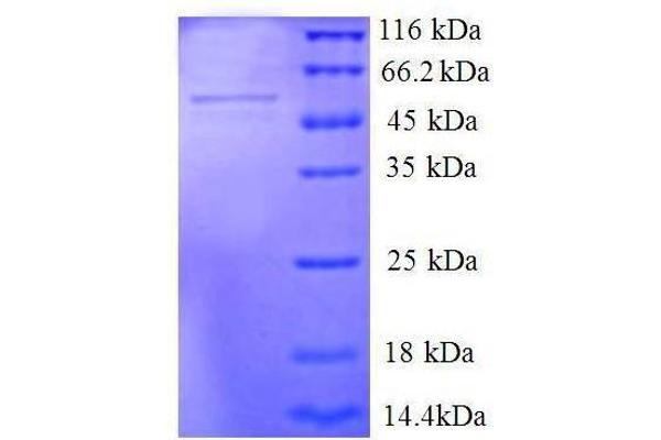 Seryl-tRNA Synthetase (SARS) (AA 2-233), (partial) protein (GST tag)