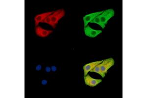 ABIN7096515 and ABIN7100579 staining Hela cells by IF/ICC.
