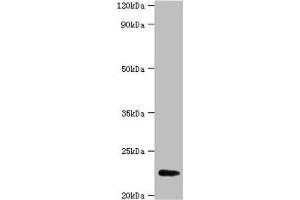 Western blot All lanes: FGF21 antibody at 2 μg/mL + A549 whole cell lysate Secondary Goat polyclonal to rabbit IgG at 1/15000 dilution Predicted band size: 23 kDa Observed band size: 23 kDa (FGF21 antibody  (AA 29-209))
