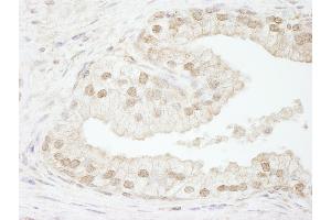 Immunohistochemistry (IHC) image for anti-Chromatin Assembly Factor 1, Subunit B (p60) (CHAF1B) (C-Term) antibody (ABIN7448454) (CHAF1B antibody  (C-Term))