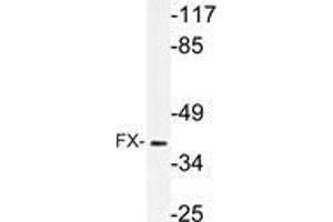 Western blot (WB) analysis of FX antibody in extracts from rat muscle cells. (TSTA3 antibody)