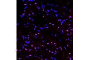 Immunofluorescence of paraffin embedded mouse heart using RNF7 (ABIN7075471) at dilution of 1:2000 (400x lens) (RNF7 antibody)