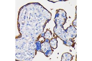 Immunohistochemistry of paraffin-embedded human placenta using Integrin alpha 5 (ITG/CD49e) (ITG/CD49e) Rabbit mAb (ABIN7267936) at dilution of 1:100 (40x lens).