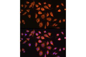 Immunofluorescence analysis of L929 cells using COPZ1 antibody (ABIN6127709, ABIN6138892, ABIN6138893 and ABIN6215734) at dilution of 1:100. (COPZ1 antibody  (AA 1-177))
