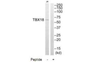 Western blot analysis of extracts from Jurkat cells, using TBX18 antibody. (T-Box 18 antibody)