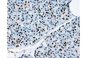 Image no. 12 for anti-Replication Protein A2, 32kDa (RPA2) antibody (ABIN1500733)