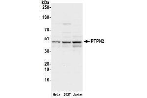 Western Blotting (WB) image for anti-Protein tyrosine Phosphatase, Non-Receptor Type 2 (PTPN2) (AA 1-50) antibody (ABIN7451019)