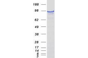 Validation with Western Blot (DAXX Protein (Transcript Variant 2) (Myc-DYKDDDDK Tag))