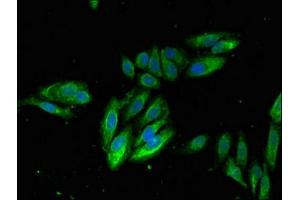 Immunofluorescent analysis of Hela cells using ABIN7156481 at dilution of 1:100 and Alexa Fluor 488-congugated AffiniPure Goat Anti-Rabbit IgG(H+L) (Integrin beta 2 antibody  (AA 37-201))