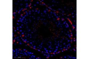 Immunofluorescence (Paraffin-embedded Sections) (IF (p)) image for anti-Transducin-Like Enhancer of Split 1 (E(sp1) Homolog, Drosophila) (TLE1) antibody (ABIN7075961)