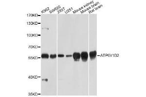 Western blot analysis of extracts of various cell lines, using ATP6V1B2 Antibody. (ATP6V1B2 antibody  (AA 262-511))