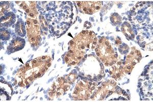 Human kidney; ZFPL1 antibody - middle region in Human kidney cells using Immunohistochemistry