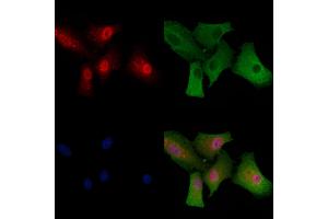 ABIN6260150 and ABIN6279147 staining  cells by IF/ICC. (ATXN7 antibody  (Internal Region))