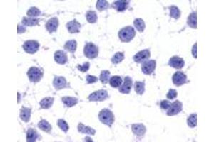 Anti-GPR45 antibody immunocytochemistry (ICC) staining of untransfected HEK293 human embryonic kidney cells. (GPR45 antibody  (Cytoplasmic Domain))