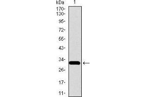 Western blot analysis using SLC27A5 mAb against human SLC27A5 recombinant protein. (SLC27A5 antibody  (AA 508-570))