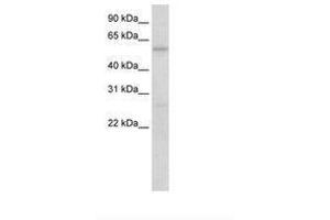 Image no. 1 for anti-Hypermethylated in Cancer 2 (HIC2) (N-Term) antibody (ABIN6736170)