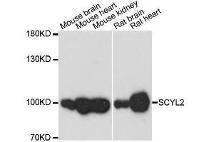 Western blot analysis of extracts of various cell lines, using SCYL2 antibody. (SCYL2 antibody  (AA 1-300))