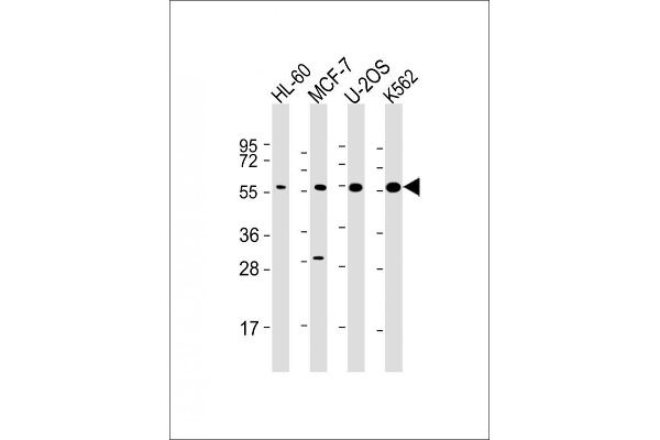 EIF2B3 Antikörper  (AA 110-452)