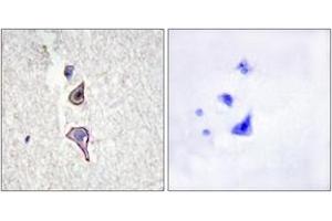 Immunohistochemistry (IHC) image for anti-Mannose Receptor, C Type 2 (MRC2) (AA 121-170) antibody (ABIN2889787) (MRC2 antibody  (AA 121-170))