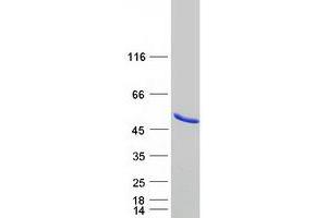 Western Blotting (WB) image for Methionyl Aminopeptidase 1 (METAP1) protein (Myc-DYKDDDDK Tag) (ABIN2725865)