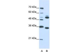 Western Blotting (WB) image for anti-WD Repeat Domain 6 (WDR6) antibody (ABIN2462385) (WDR6 antibody)