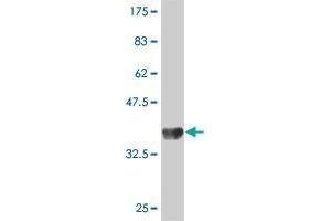 Western Blot detection against Immunogen (37. (TRIM58 antibody  (AA 346-445))