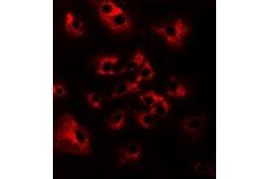 Immunofluorescent analysis of HAI-2 staining in Hela cells.