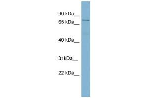 WB Suggested Anti-TGM4  Antibody Titration: 0. (TGM4 antibody  (N-Term))