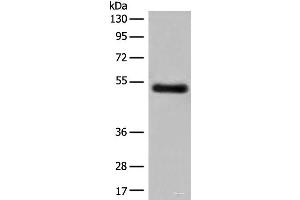 Western blot analysis of Human breast cancer tissue lysate using GK5 Polyclonal Antibody at dilution of 1:500 (GK5 antibody)