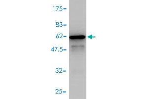 Western Blot detection against Immunogen (54. (SNAP29 antibody  (AA 1-258))