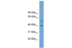Western Blot showing CLUAP1 antibody used at a concentration of 1-2 ug/ml to detect its target protein. (CLUAP1 antibody  (C-Term))