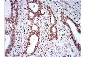 Immunohistochemistry (IHC) image for anti-KH Domain Containing, RNA Binding, Signal Transduction Associated 2 (KHDRBS2) (AA 160-349) antibody (ABIN2682997)