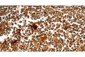 Immunohistochemistry of paraffin-embedded Human tonsil using MYOZ1 Polyclonal Antibody at dilution of 1:50 (Myozenin 1 antibody)