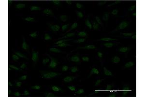 Immunofluorescence of monoclonal antibody to MYCBP on HeLa cell. (MYCBP antibody  (AA 34-103))