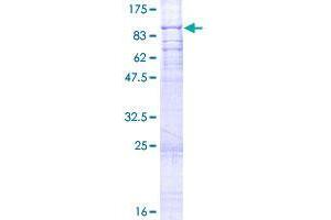 S1 RNA Binding Domain 1 (SRBD1) (AA 1-620) protein (GST tag)